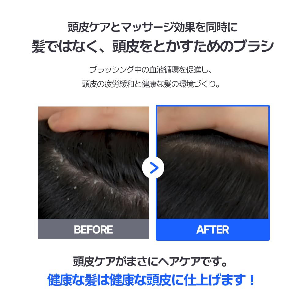 FORBEAUT DANDRUFF BRUSH