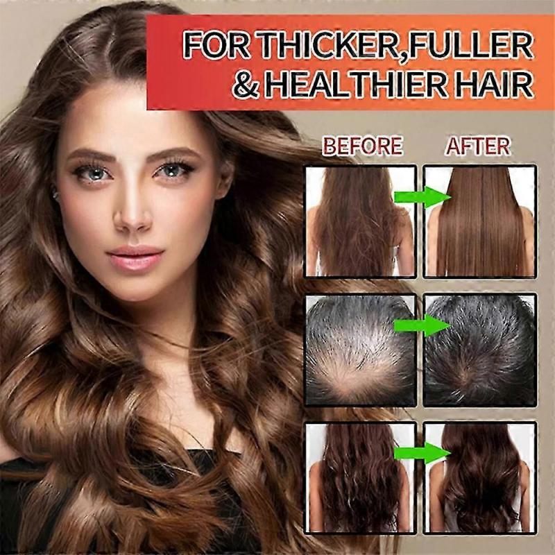 Batana Oil for Hair Growth -Natural - Prevents Hair Loss, Eliminates Spli 