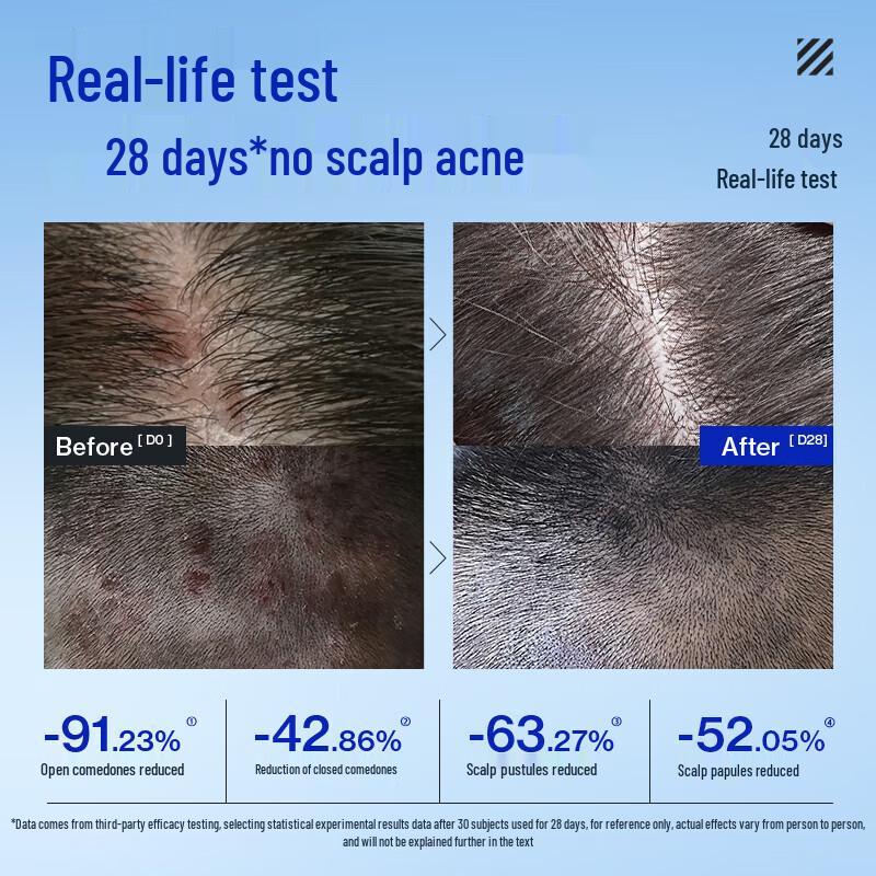 Ocean Supreme Fruit Acid Shampoo & Shower Gel Set for Men