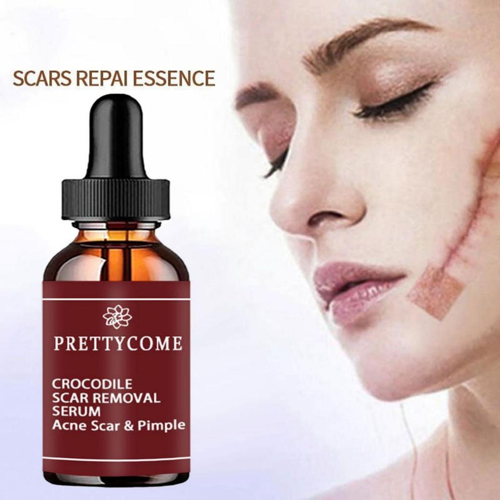 Scar removing essence repairing skin whitening brightening essential oil moisturizing and hydrating fluid