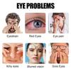 Taoters Lutein Corn Xanthan Capsules Improve Eye Fatigue and Protect Vision 120 Capsules