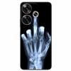 For Xiaomi Redmi 13 Case Animals Painted Black Silicone TPU Soft Bumpers for Redmi 13 4G 5G Redmi13 Phone Cover Protect Capa