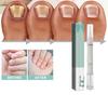 4ml Nail Repair Pen Anti Nail Dry Foot Serum Moisturizing Feet Care Nail Repair Toenail Care Tool Nail  Strengthening Serum Nails Nutrition Oil