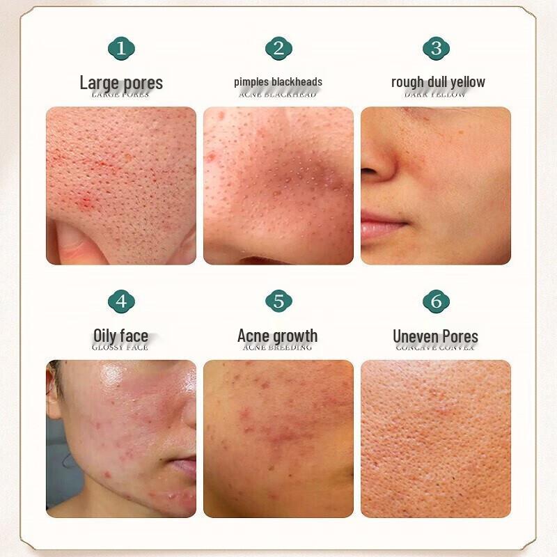 Tong Ren Tang Deep Cleansing Blackhead & Pore Refining Masks