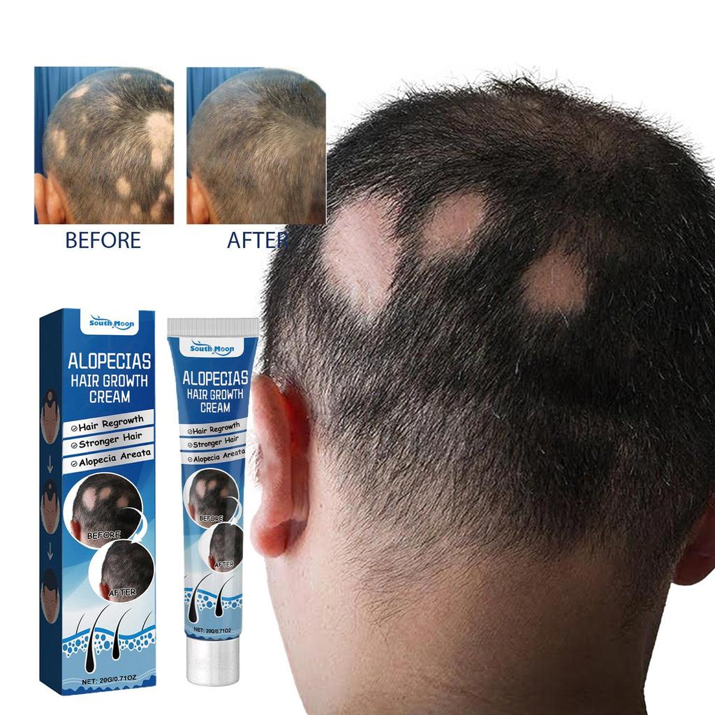 Cream Anti Hair Loss Products Fast Growing Prevent Dry Frizz Damaged Repair Treatment Scalp Beard Care Men Women 20g