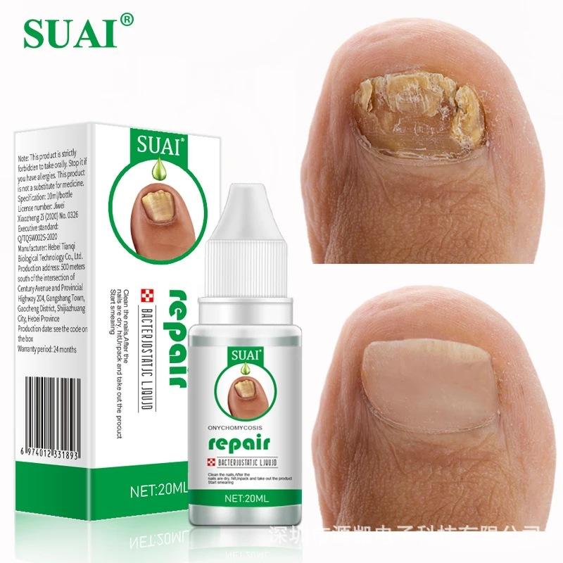 SUAI Nail Fungus Repair Liquid - Toenail Fungus Treatment, Antifungal Solution for Nail Bed, Cuticle Care, Portable Clear Liquid 30ml