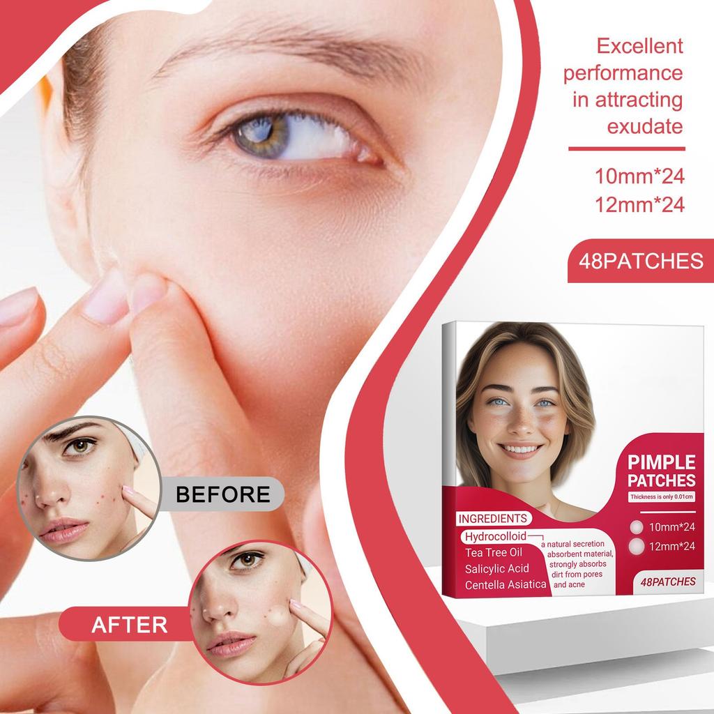 Transparent Rectangular Acne Patch With Thorns 48 Pieces Acne Patch Concealer Hydrocolloid Acne Patch