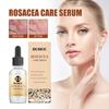 Soothing Repair Serum Redness Relief Hydrating Essence 30ml Face Care Sensitive Skin