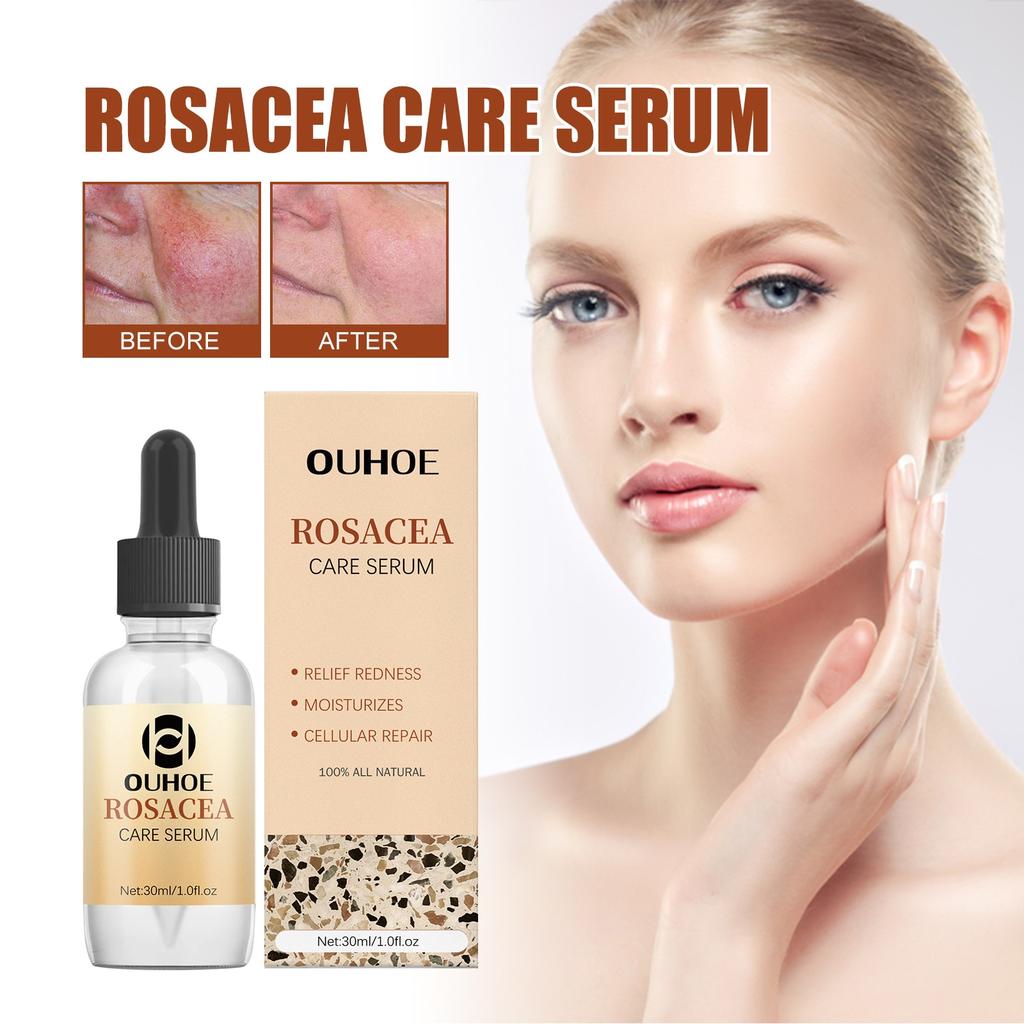 Soothing Repair Serum Redness Relief Hydrating Essence 30ml Face Care Sensitive Skin