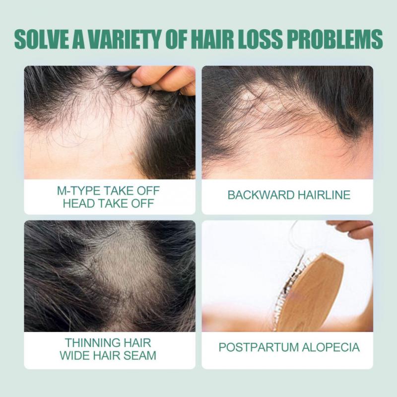 7-Day Hair Growth Serum - Nourishing Essential Oil for Scalp & Hairline Hydration