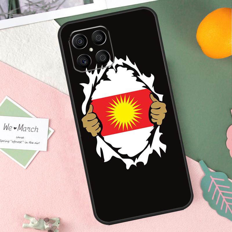 

Yazidi Flag Ezidxan Case For Honor X9b X8b X9a X8a X8 X9 X9c 50 70 90 Lite Honor 200 Pro Magic 7 5 6 Lite Cover Honor 90 Lite
