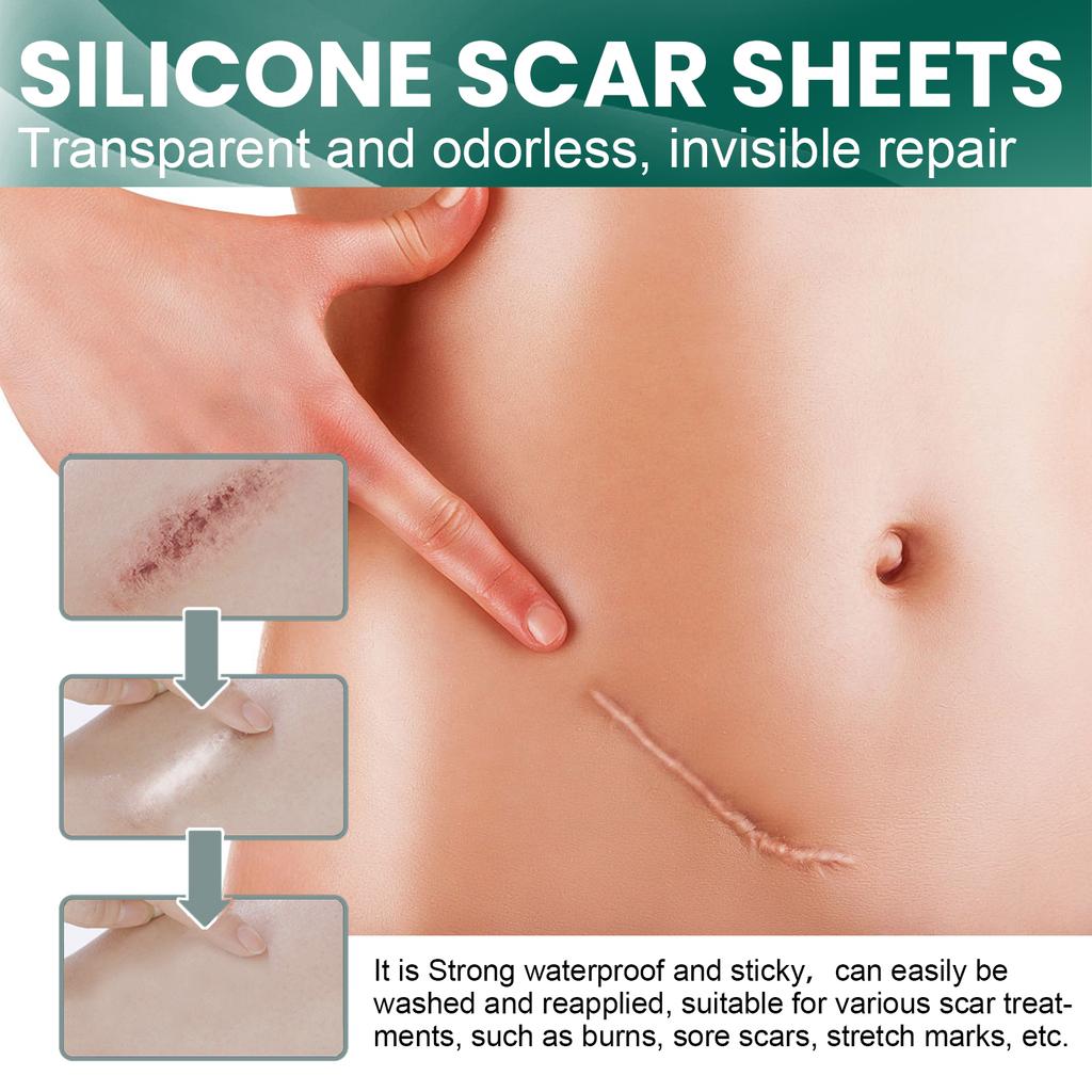 EELHOE 1 Roll Silicone Scar Removal Sheets for C-Section Postoperative Skin Colored Invisible Beauty Tape