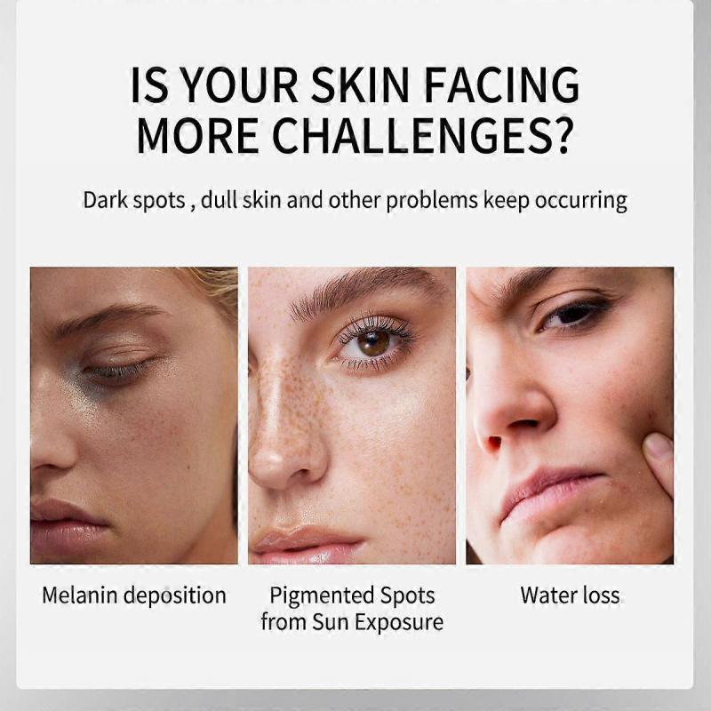 Arbutin 7% Tranexamsäure 4% Creme 50ml Aufhellend K-Beauty 50g