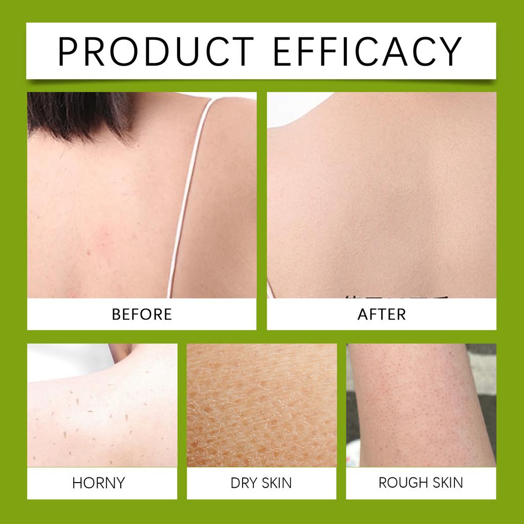 Soothing Soap Bar Tea Oil Skin Soothing Soap Is Suitable For Sensitive Skin To Redness, Swelling And Itching Bath Soap