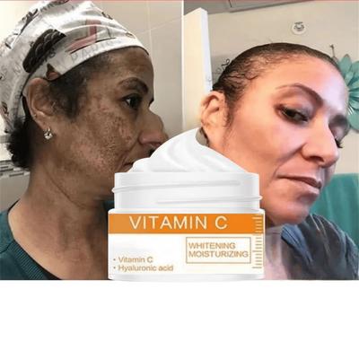 La crema alla vitamina C illumina il tono della pelle, attenua le linee sottili, restringe i pori, idrata la crema per il viso delle persone pigre