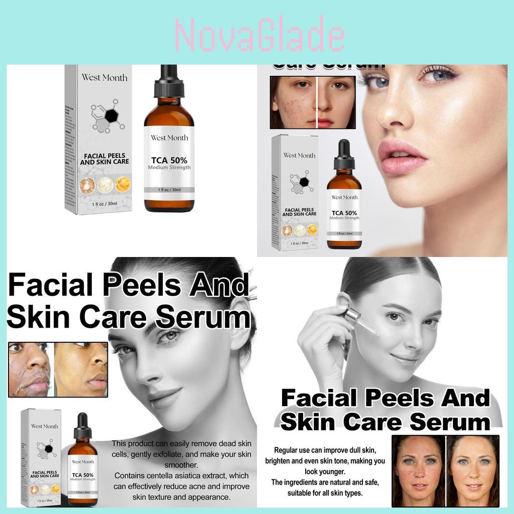 West Month Anti-acne Repair Serum For Diminishing Dark Spots And Cleansing Skin Imperfections