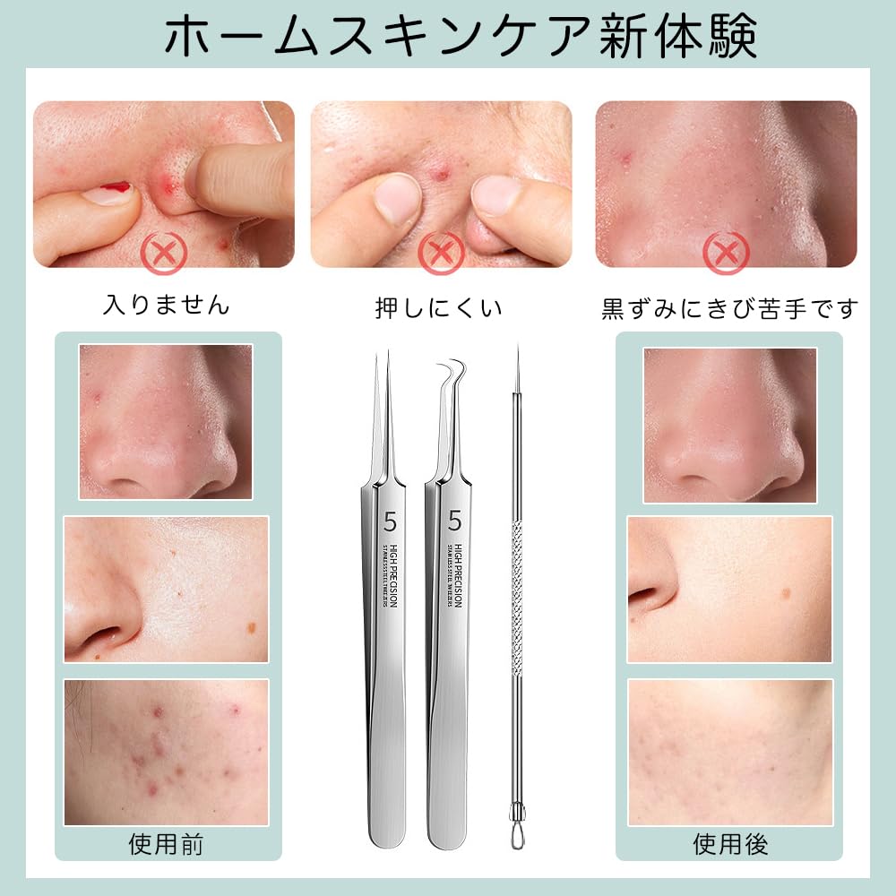 Blackhead Removal Set with Storage Precision Blackhead Removal by a Beauty Salon Grade Tip for Easily Remove Perfect for Strawberry and Precision