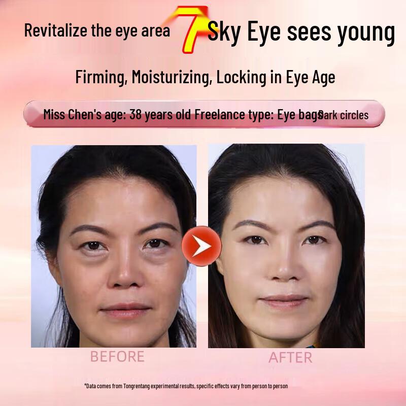 Nanjing Tong Ren Tang Eye Treatments