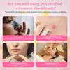 Skin Spatula, 2.76x1.77in Portable Face Scraper Scrubber Blackhead Remover Tools Pore Cleaner Practical Facial Deep Cleansing Tools and Gifts for