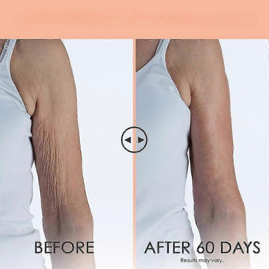 Crepe Erase Advanced Body Repair Treatment, Anti-Aging Wrinkle Cream, Support Skin Natural Elastin & Collagen Production - Hydrating, Body Firm Cream,