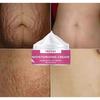 Pregnancy Stretch Mark Repair Cream Maternity Obesity Skin Postpartum Stretch Scar Body Marks Remover Smooth Skin Care