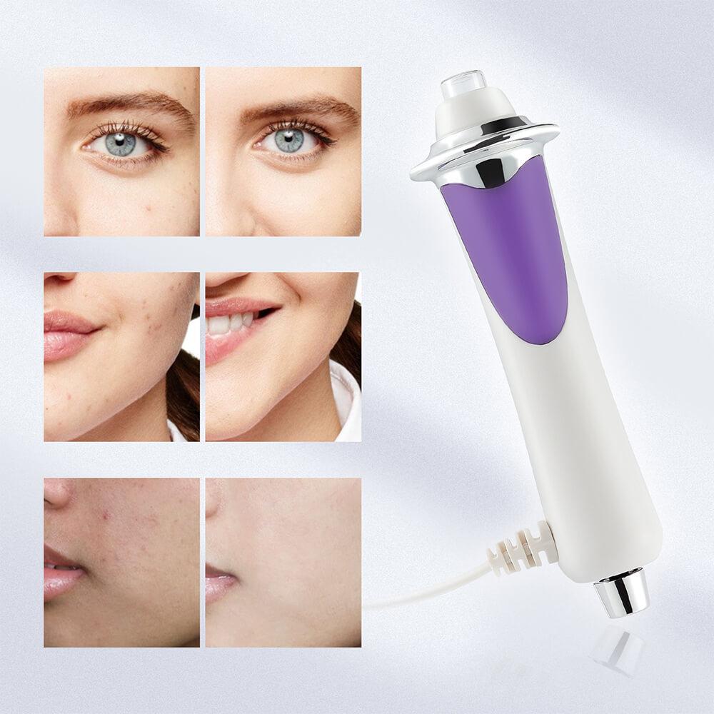 12Levels RF Radio Frequency Face Lifting Machine EMS Micro current Skin Rejuvenation Tighten Brighten Beauty Machine
