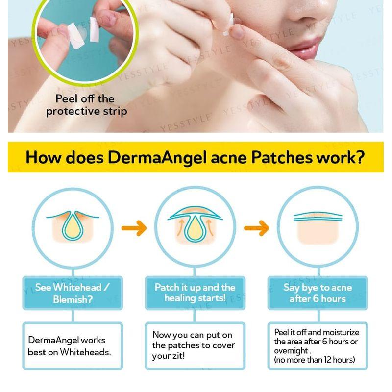 DermaAngel - Denní náplasti na akné s kyselinou salicylovou Plus 24 ks