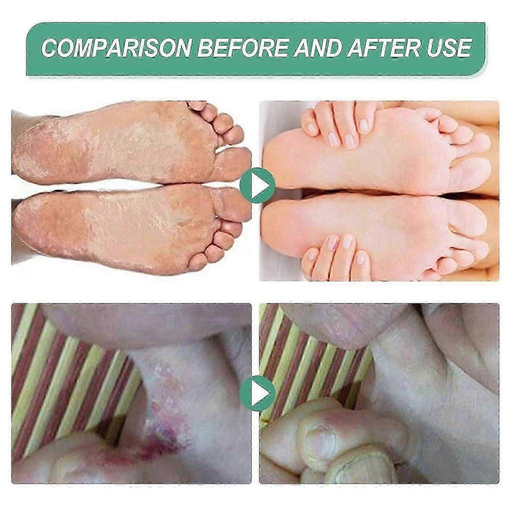 South Moon Deodorant Foot Spray Moisturizing Skin Deodorant Spray
