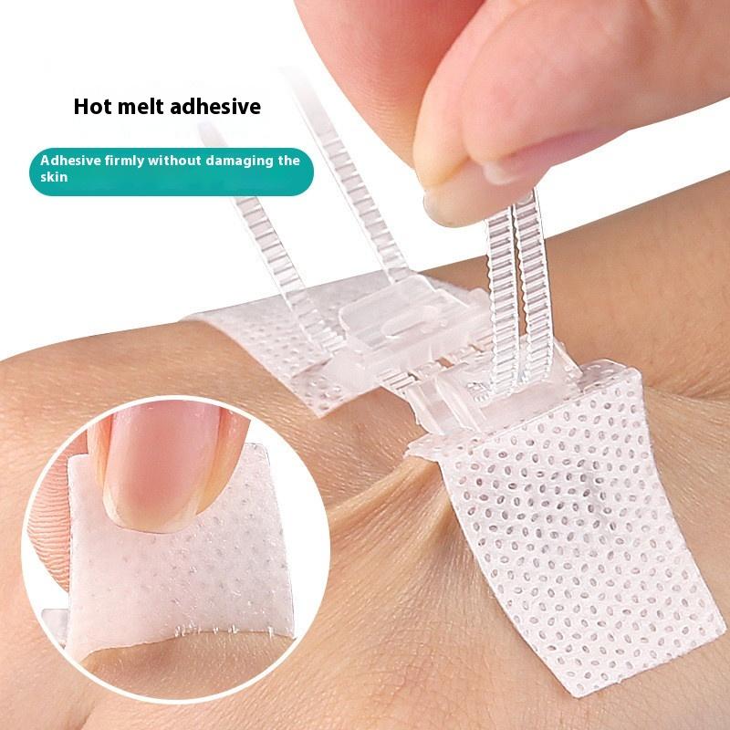 Reißverschluss-Krawatte Wundverschluss-Pflaster Hämostatisches Pflaster Wunde Schnell Ohne Naht Reißverschluss Outdoor-Pflaster Tragbar Schnell Gerinnendes Wund