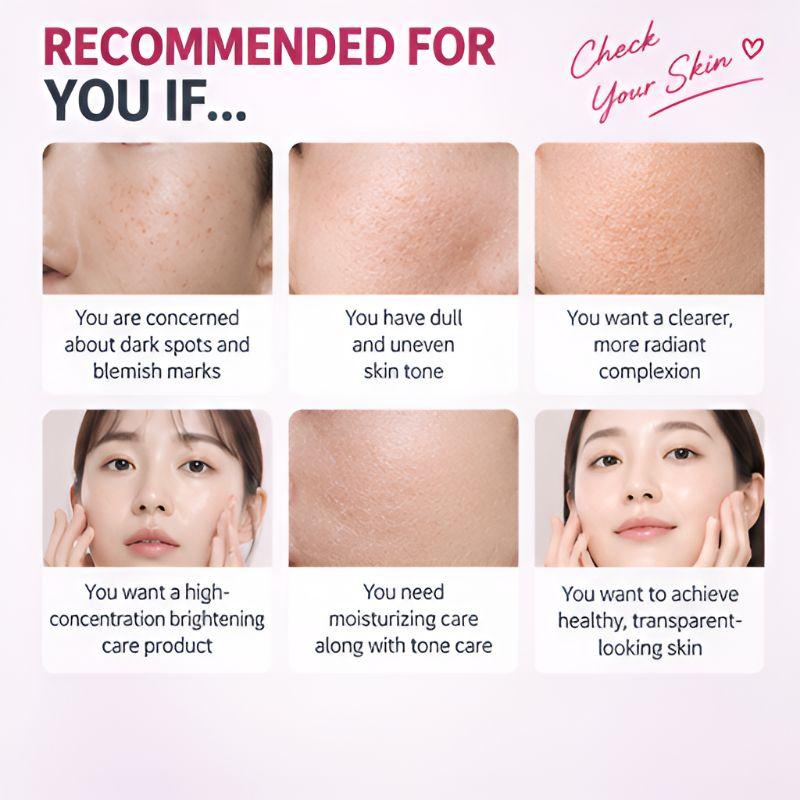 TOSOWOONG Arbutin 7% + Tranexamic Acid 4% Cream Dark Spot Brightening Uneven Skin Tone Care 50ml