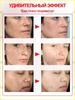 Retiderm anti-aging face cream, Freckle removal and whitening cream is able to remove freckles, chloasma, sunspots, age spots, Contains hyaluroni