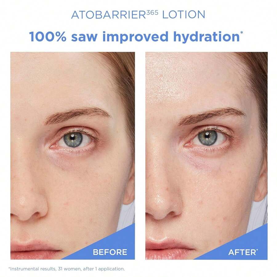 AESTURA ATOBARRIER365 Lightweight Korean Facial Moisturizer Lotion 150ML With Ceramides | Fast-Absorbing Hydration, Strengthens Skin Barrier
