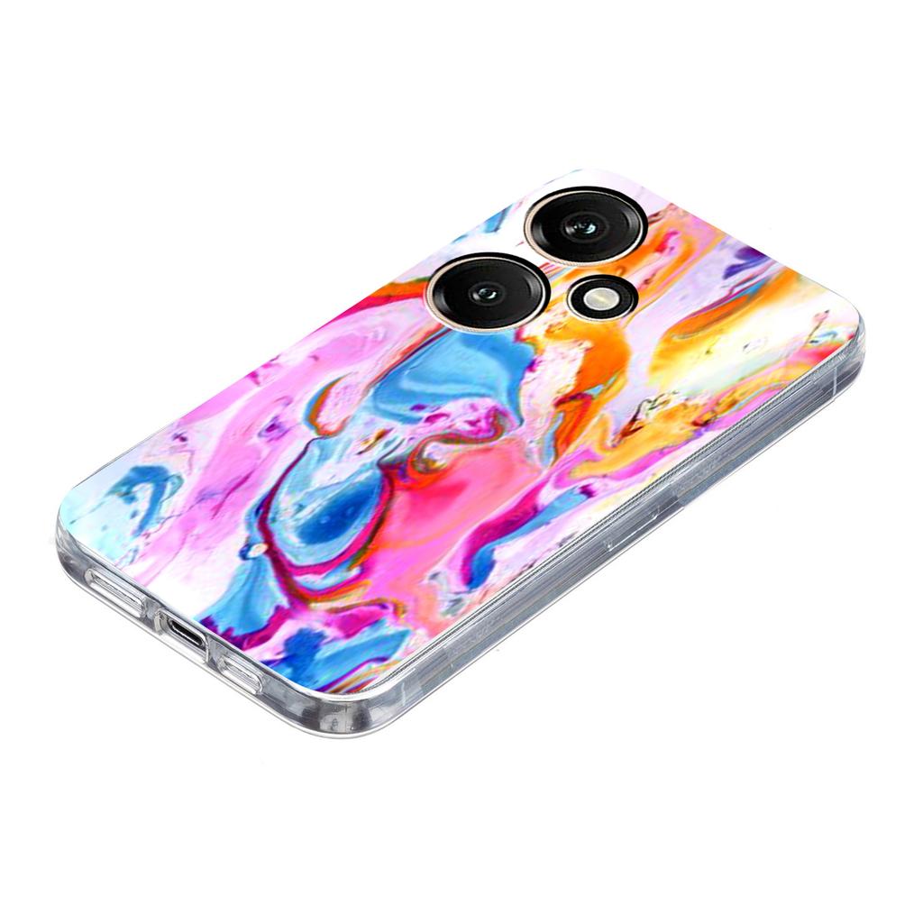 For Honor 400 5G (Global) Case Marble Pattern Printing Soft TPU Phone Cover