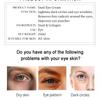 Snail Eye Cream Nourishing Dry Skin Fade Fine Lines Brighten Eye Collagen Cream Remove Dark Circles Eye Bags Skin Care Eye Bal