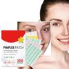 Parche reparador de acné, cuidado de la piel Facial, manchas de decoloración, marcas de espinillas, cubierta cerrada para imperfecciones de acné, parche reparador de espinillas