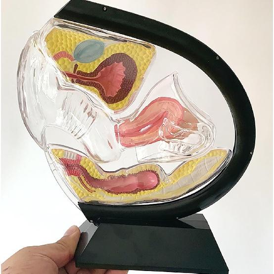 Female Transparent Uterus Anatomical Model, Uterus Model, Pelvis Rectum Teaching Model, for Medical Education and Training(Black)