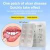 Szybka Pielęgnacja Plaster na Owrzodzenia Jamy Ustnej Opatrunek na Rany Jamy Ustnej Do Aft Szybka Ulga w Bólu Lek na Afty Środek Przeciwbólowy