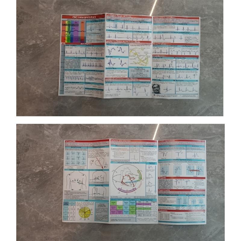 Professional Electrocardiogram Instruction Poster Double Side EKG Pocket Guide Reference for Students Nurse Doctor