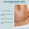 Laniska Silicone Scar Tape, 4cm×150cm, Soft & Breathable, for Scar Care & Skin Smoothing