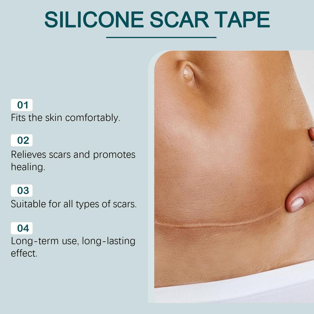 Laniska Silicone Scar Tape, 4cm×150cm, Soft & Breathable, for Scar Care & Skin Smoothing