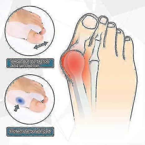 3 Paar X Gel Hallux-Valgus-Korrektor Zehenschützer Begradiger Separatoren Zehenspreizer (6 Stück)