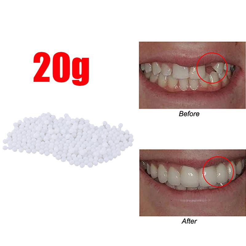 10g-100/bag Tooth Repair Kit-thermal Beads For Filling Fix The Missing And Broken Tooth Or Adhesive The Denture Fake Teeth Gutta