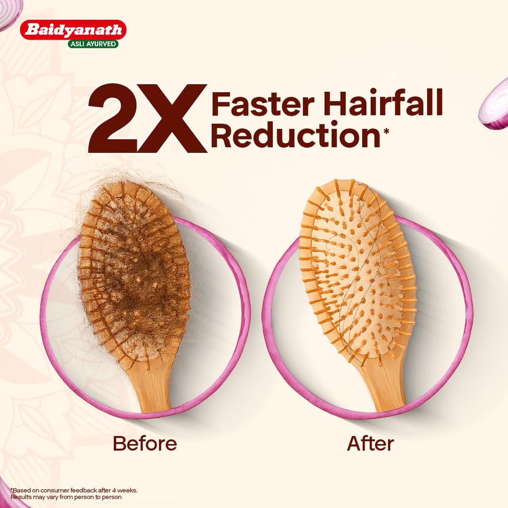 Baidyanath Red Onion Hair Oil 200ml | Natural Hair Nourishment For Stronger, Shinier, Smoother Hair | Reduces Hair Fall & Promotes Growth