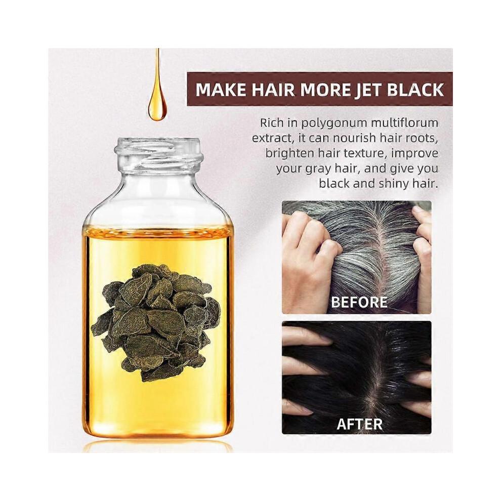 2x Anti-hair Loss Polygonum Multiflorum Oil Cover Gray Hair To Dye Canas Black Hair Growth Oil Repair Women Damaged Hair Root Care