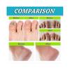 3Pcs Foot And Nail Spary, Natural And Powerful Foot Care-KAKA