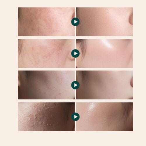 Creme Funcional de Grau FarmacêuticoREJUALL Creme Reparador Avançado PDRN 20gRegeneração da Pele K-Beauty Premium