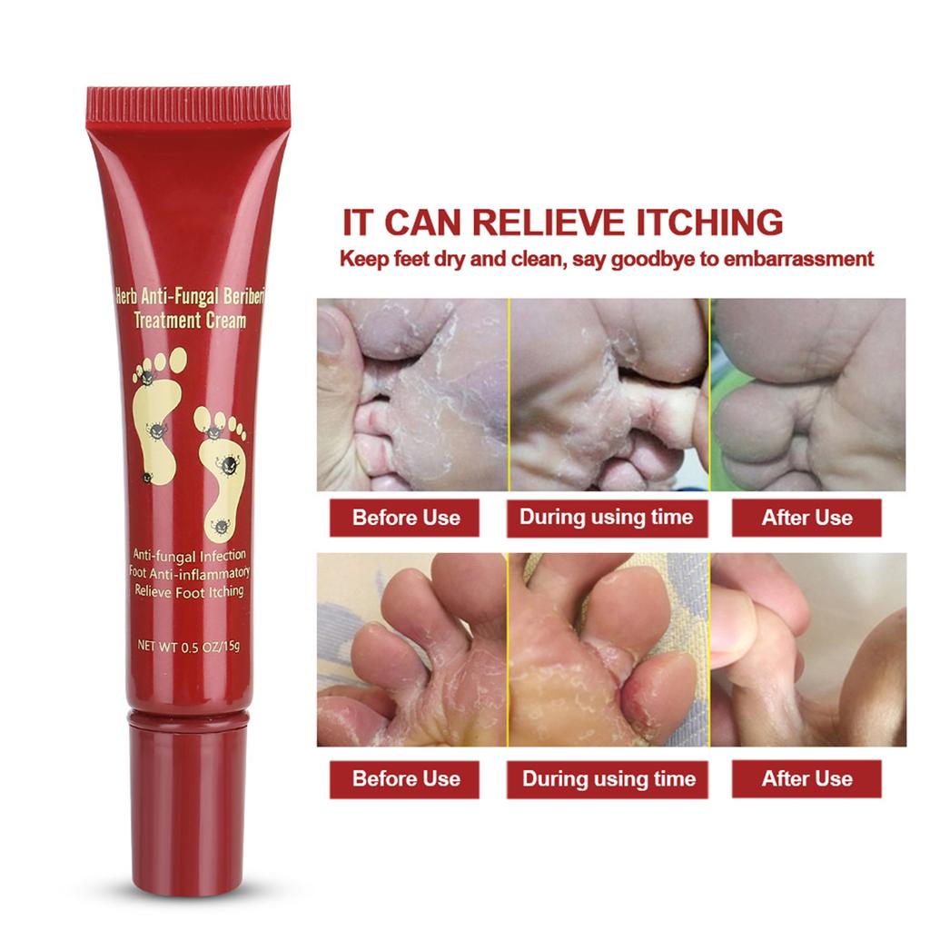 15g Natural Plant Foot Treatment Cream Moisturizer Feet Ointment Anti Fungal Relieving Itching