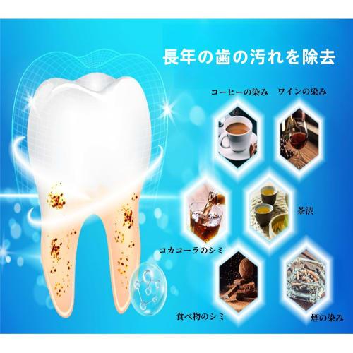 Whitening Sheets [2025 Innovative 9D / Dentist Recommended] Portable Teeth Whitening Stickers, Perfect for Travel (28 Sheets, 14-Day Supply)