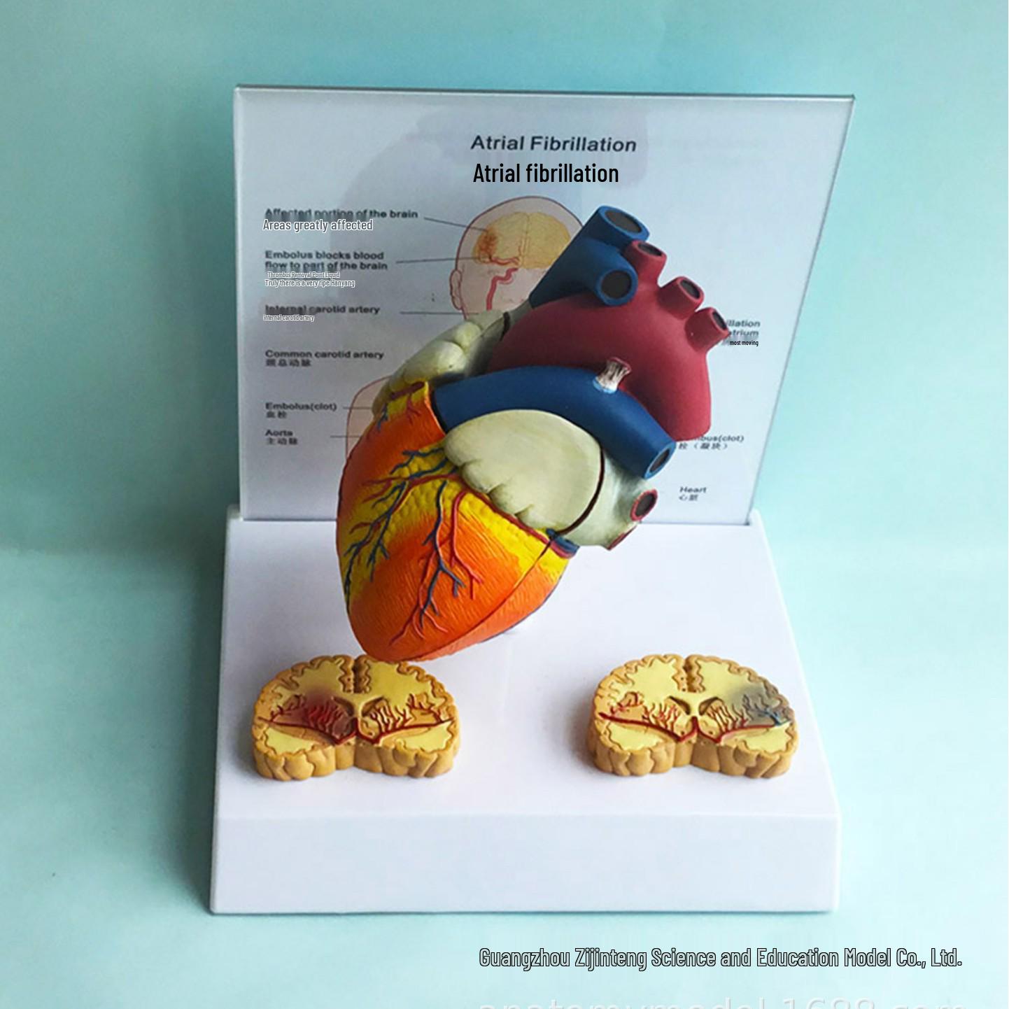 

Atrial Fibrillation PVC Heart and Brain Anatomical Teaching Model for Medical Research 18 x 15 x 19 cm