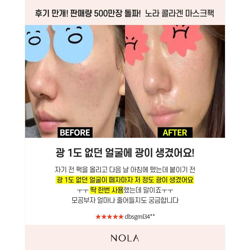 Nora Pore Solution Collagen Mask Pack, 4 sheets, 2 packs